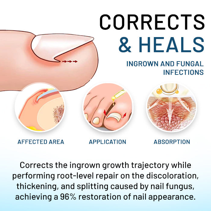 AEXZR® Bio-Soft Nano-Regeneration Liquid🚨The Only System That Eliminates "Knife-Like" Nail Pain in Minutes Without Surgery
