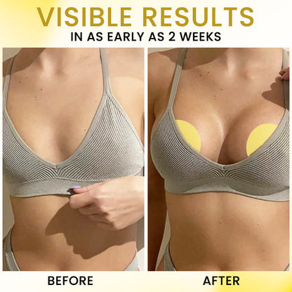 💉1800 Dissolving Needles + 95% Deeper Absorption💎AEXZR® Apex-Lift Volumizing & Lifting Microneedle Bust Patch