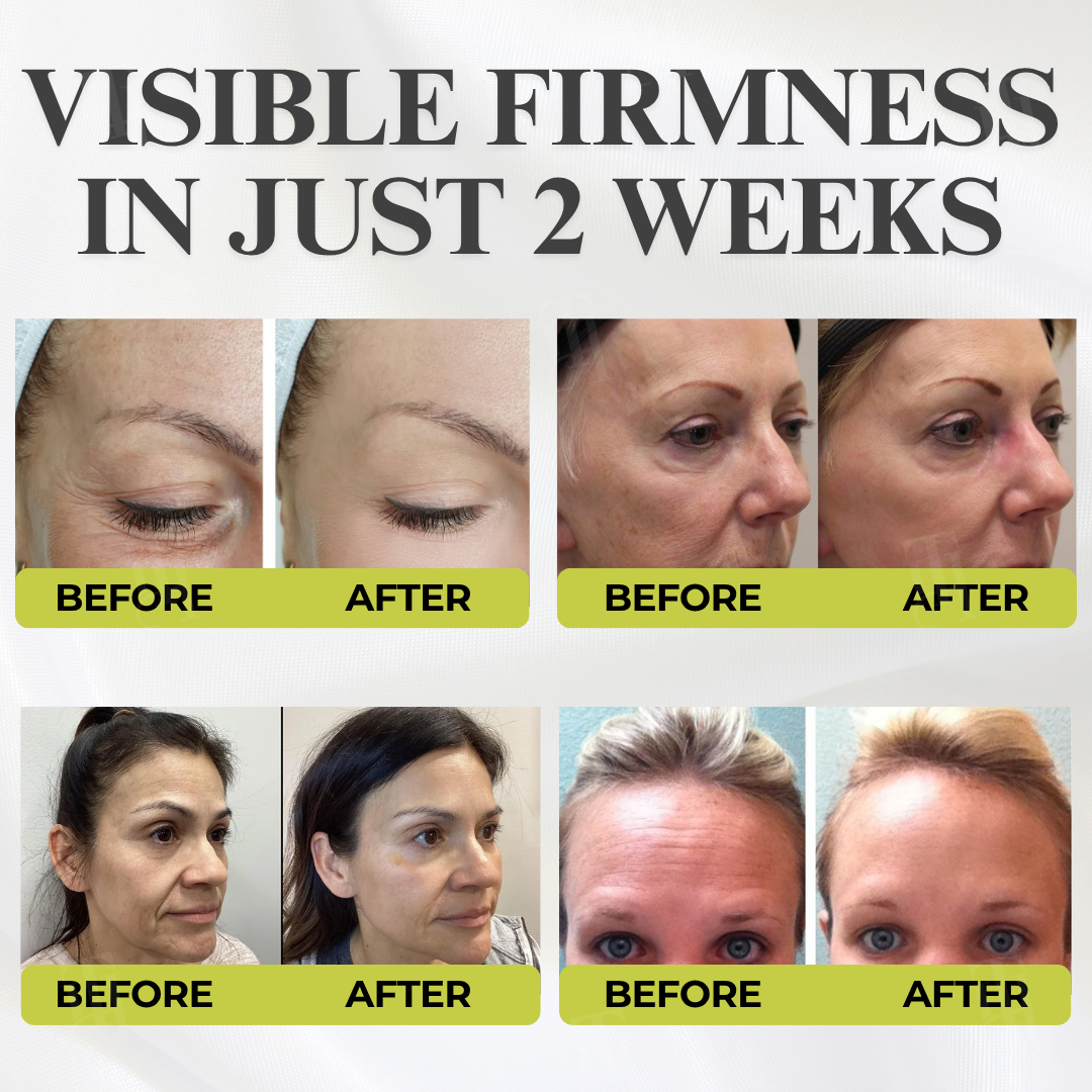 🔥 BUY 2 SAVE BIG | Needle-Free Facelift | AEXZR® Botox & Vita-A Retinol Shot Wrinkle - Lift Tightening Cream