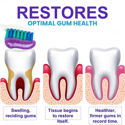🛑Stop Gum Recession + Clinical Strength Formula🏥AEXZR® Apisphere Dental Repair Toothpaste