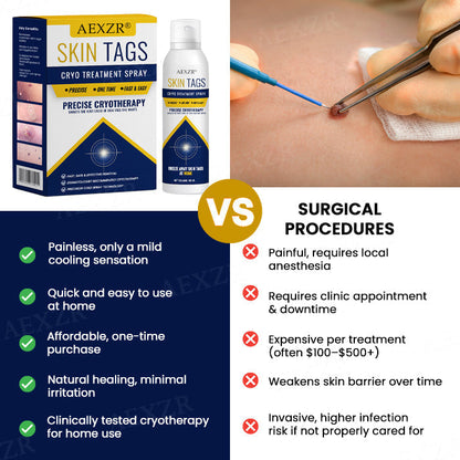 ✨ Painless At-Home Removal | AEXZR® Skin Tag Cryo Treatment Spray