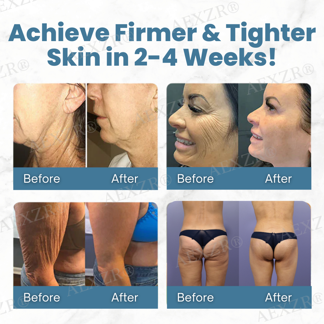 🔬 Clinical-Grade Anti-Aging Breakthrough | AEXZR® Anti-Wrinkle Skin Cream🌟