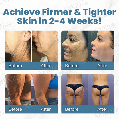 🔬 Clinical-Grade Anti-Aging Breakthrough | AEXZR® Anti-Wrinkle Skin Cream🌟