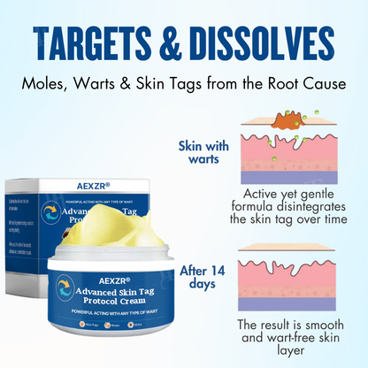🔥EXCLUSIVE: Professional-Grade Skin Restoration Now Available at Home | AEXZR® Protocol Cream: Remove Tags, Keep Perfect Skin⭐