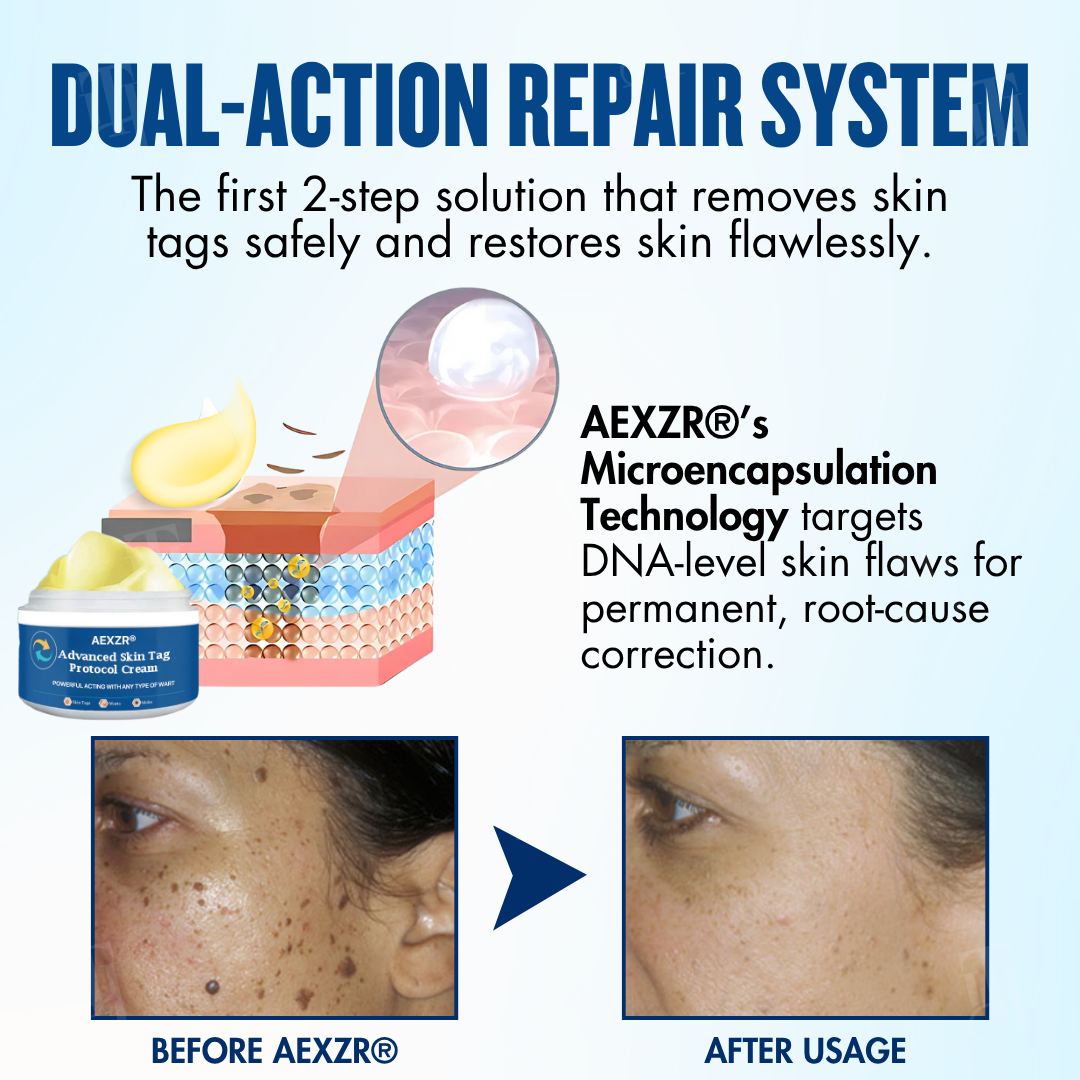 🔥EXCLUSIVE: Professional-Grade Skin Restoration Now Available at Home | AEXZR® Protocol Cream: Remove Tags, Keep Perfect Skin⭐