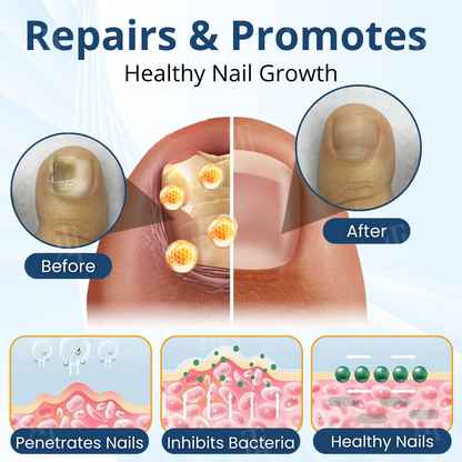 ⚡Visible Results In 2 Days + Professional Grade Repair🏥AEXZR® MycoShield Pro Fungal Nail Patches