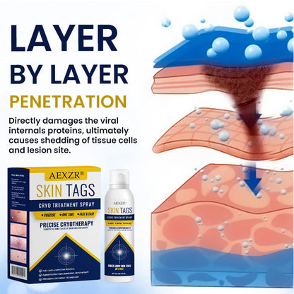 ⚡Instant Removal Power + Clinic-Grade Results🏆AEXZR® Skin Tag Cryo Treatment Spray