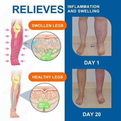 🌟Breakthrough Nano-Penetration + FDA-Registered Quality💎AEXZR® LYMPHEDEMA Drainage Massage Cream