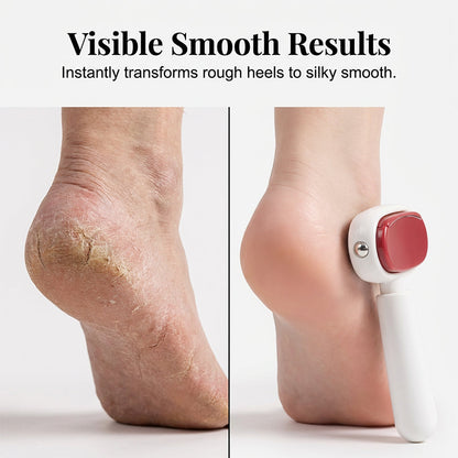 ⏰Last Day Buy 1 Get 1 Free $8.99 Each!!🔥Double-Sided Foot Scraper for Callus Removal
